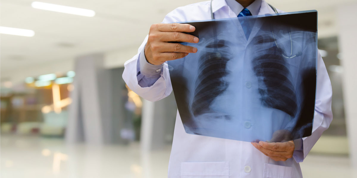 Health professional examining an x-ray.